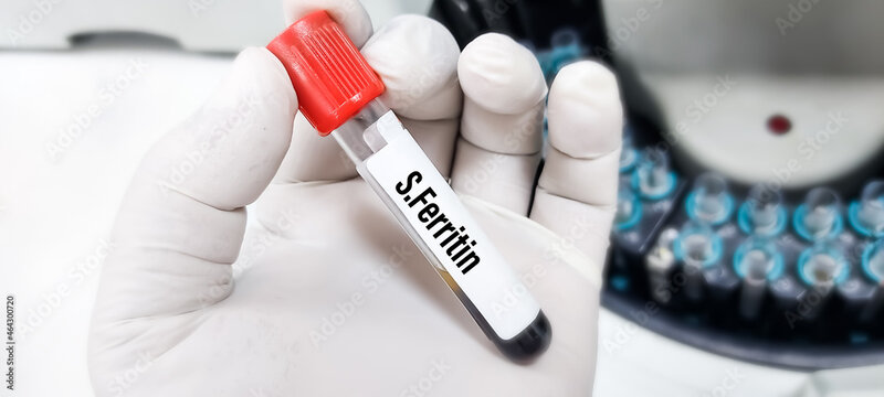 Qanda ferritin nədir?