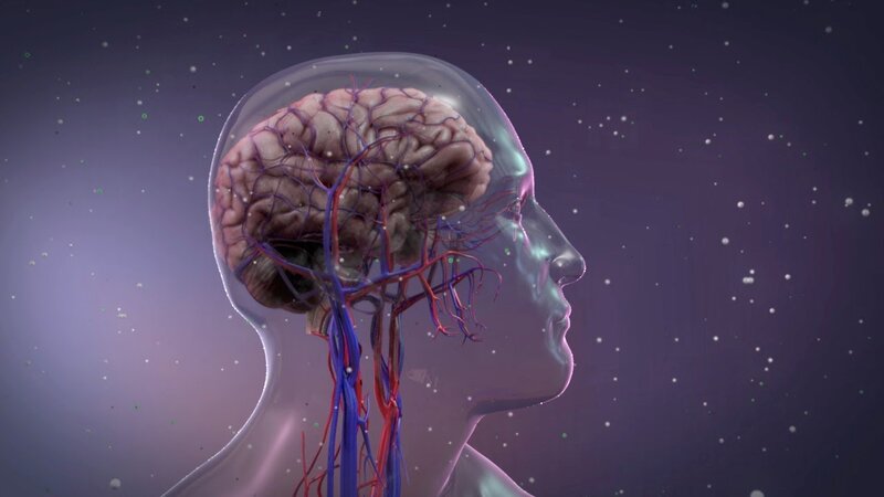 Dumanlı beyin sindromu xəstəlikdir?