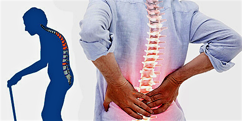 Osteoporoz nədir?