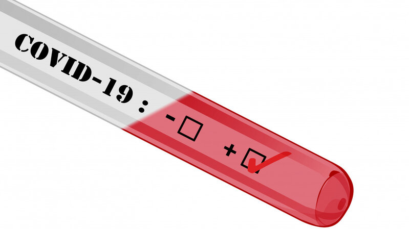 Koronavirus pandemiyası (COVİD 19)