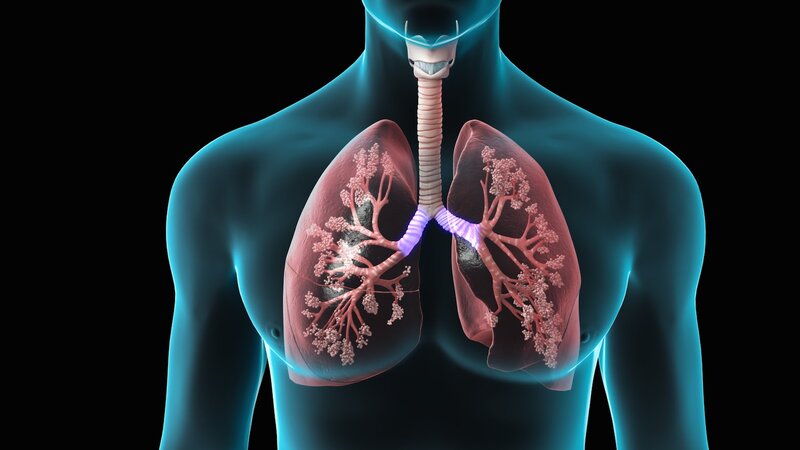 Ağciyər ödəmi (pulmoner ödəm) nədir?