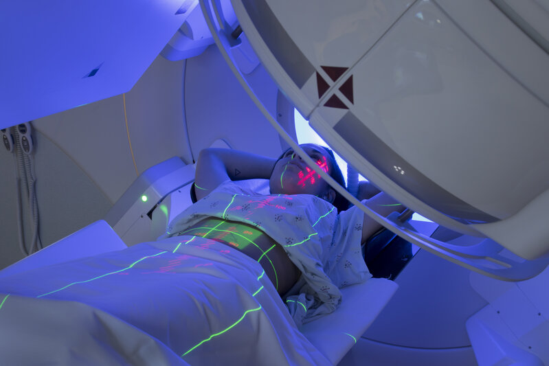 Radioterapiyanın xərçəng müalicəsində faydası varmı?
